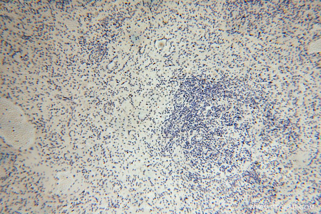 Immunohistochemistry (IHC) staining of human spleen tissue using LARP7 Polyclonal antibody (17067-1-AP)