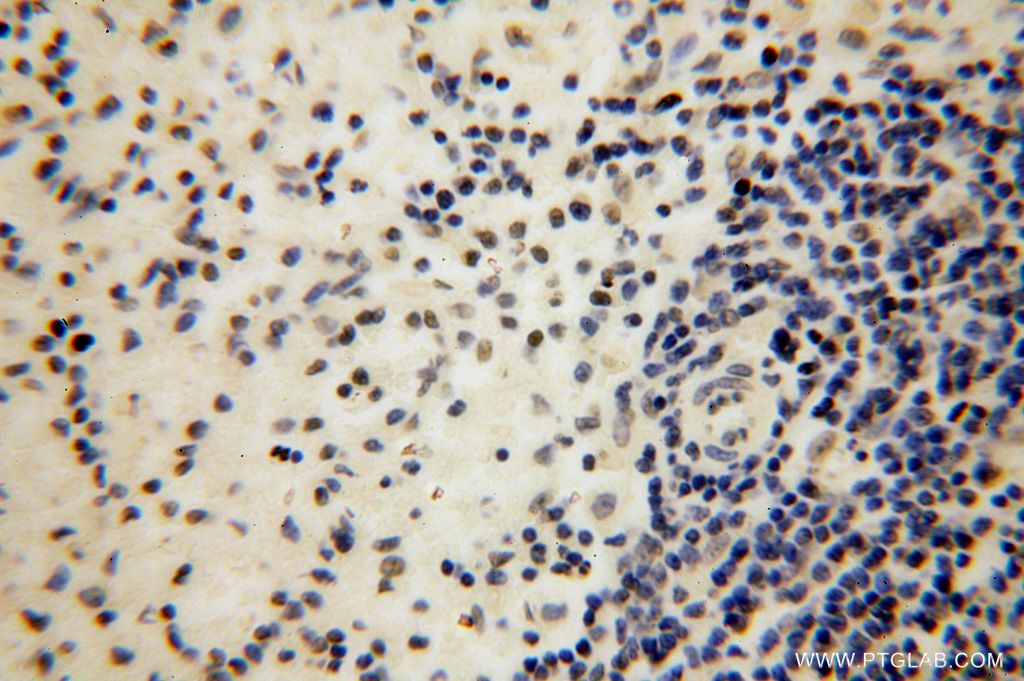 Immunohistochemistry (IHC) staining of human spleen tissue using LARP7 Polyclonal antibody (17067-1-AP)