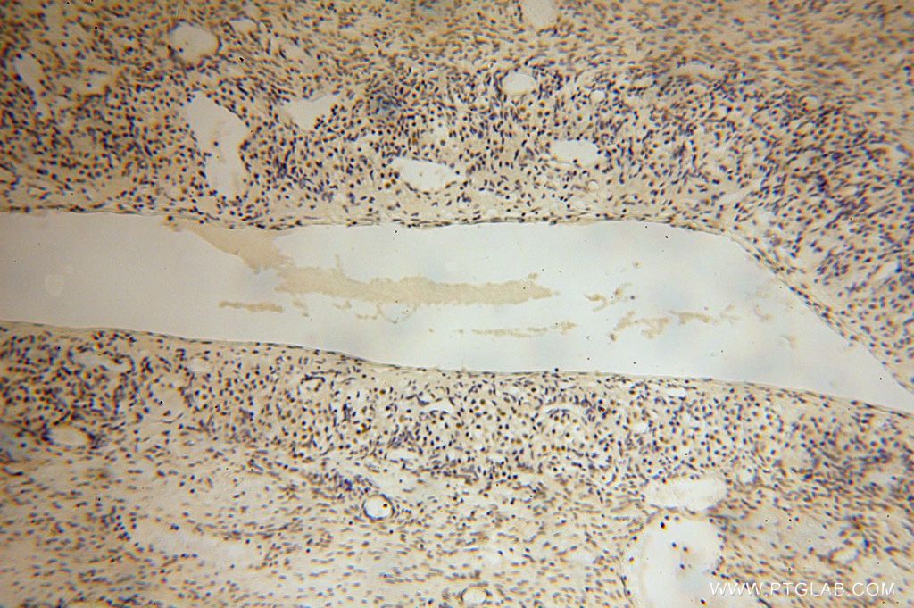 Immunohistochemistry (IHC) staining of human ovary tissue using LARP7 Polyclonal antibody (17067-1-AP)