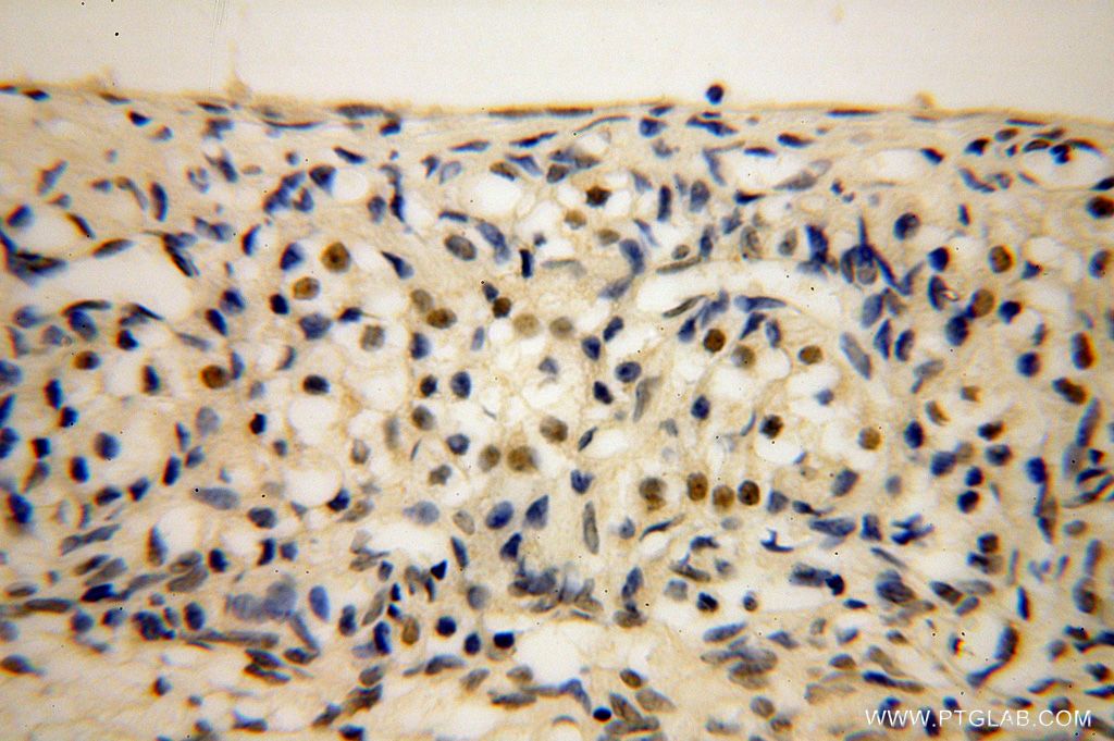 Immunohistochemistry (IHC) staining of human ovary tissue using LARP7 Polyclonal antibody (17067-1-AP)