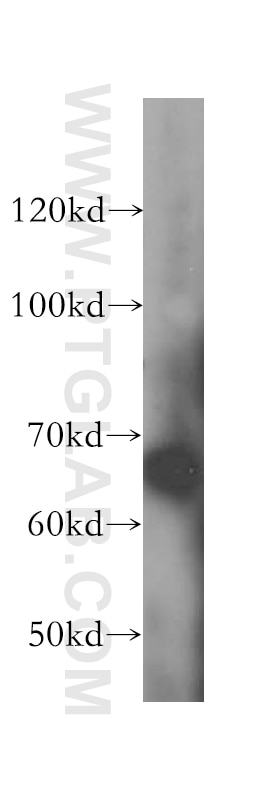 Western Blot (WB) analysis of human brain tissue using LARP7 Polyclonal antibody (17067-1-AP)