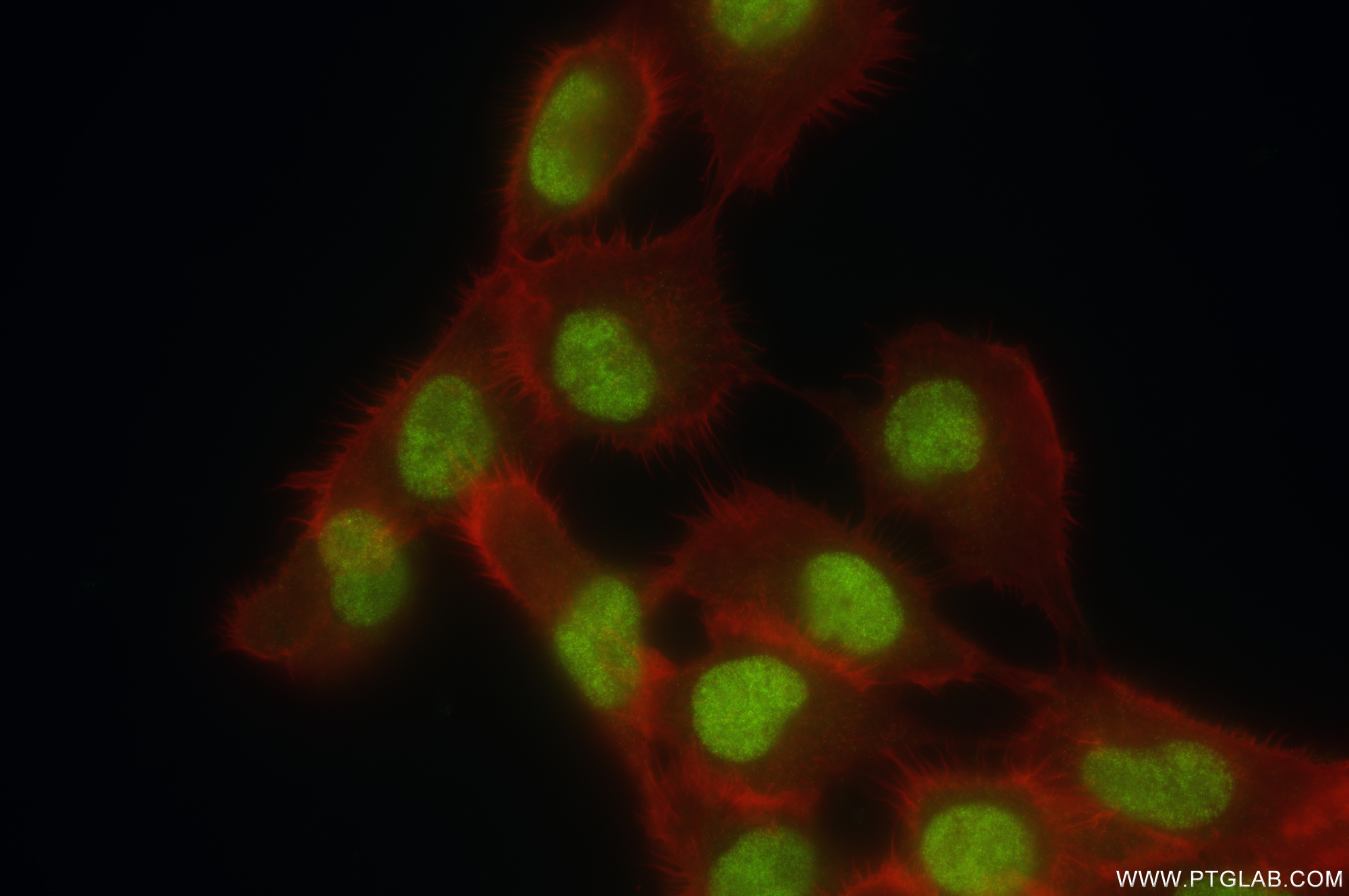 Immunofluorescence (IF) / fluorescent staining of A431 cells using LARP7 Recombinant antibody (84950-3-RR)