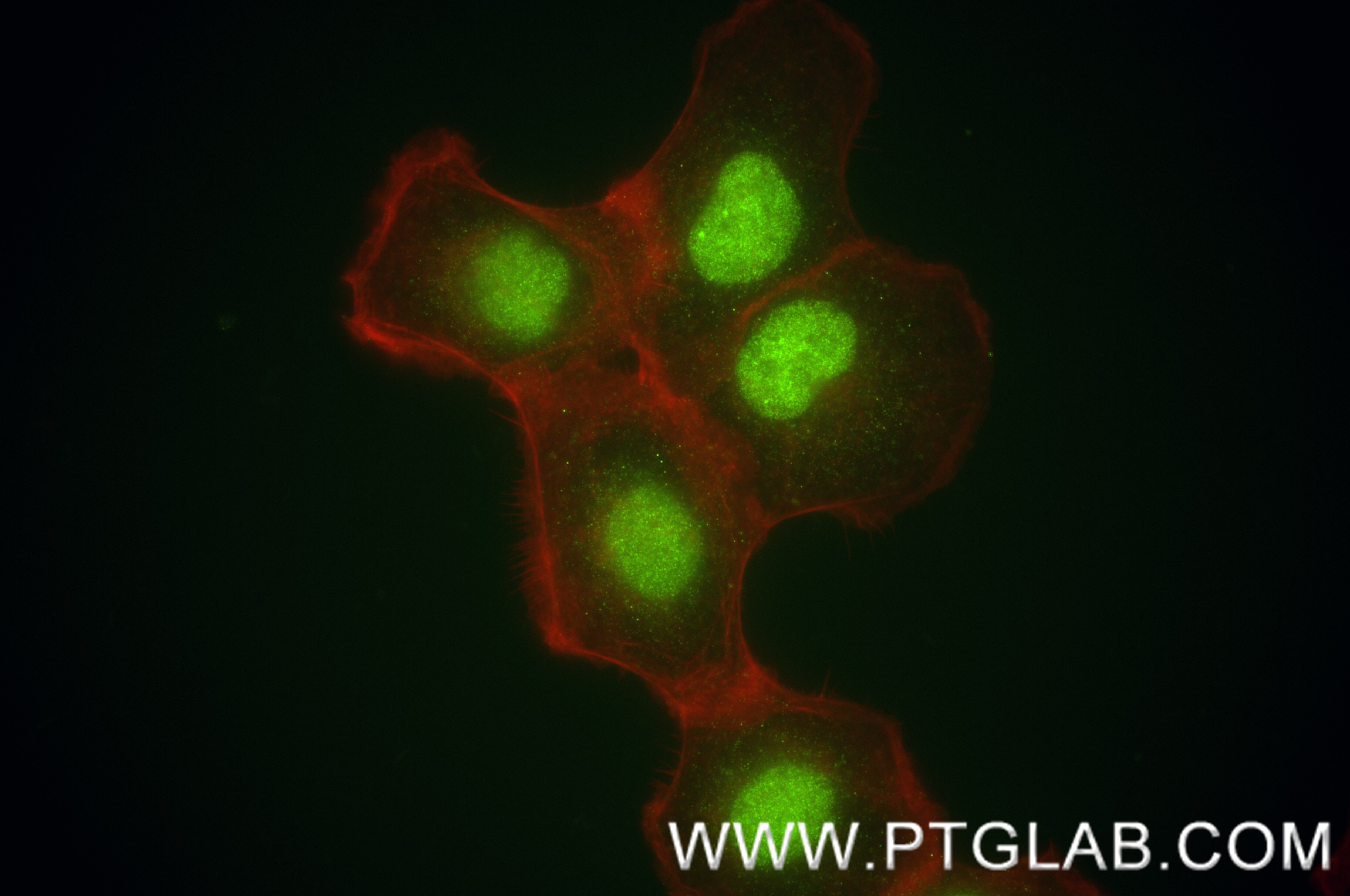 Immunofluorescence (IF) / fluorescent staining of A431 cells using LARP7 Recombinant antibody (84950-3-RR)