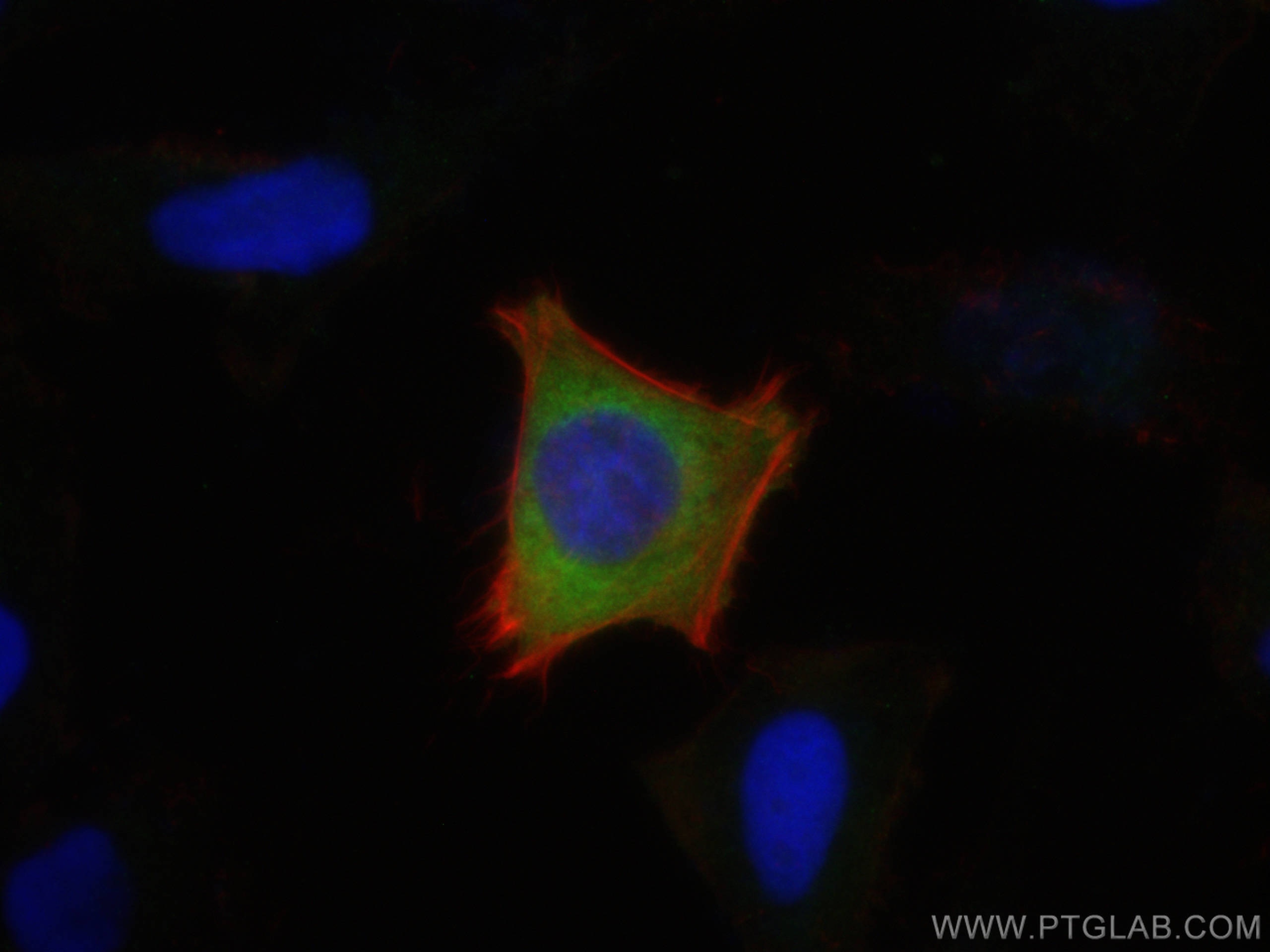 Immunofluorescence (IF) / fluorescent staining of HeLa cells using LARS Polyclonal antibody (21146-1-AP)
