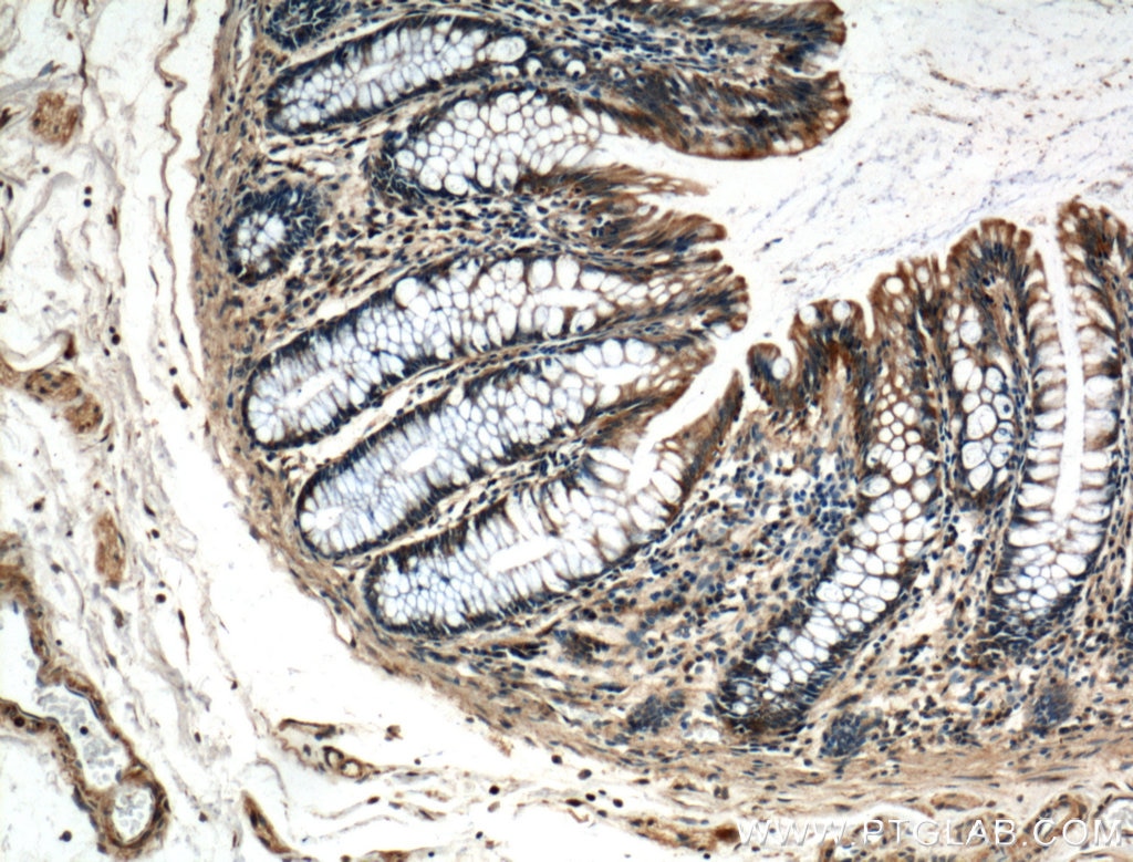 Immunohistochemistry (IHC) staining of human colon tissue using LARS Polyclonal antibody (21146-1-AP)