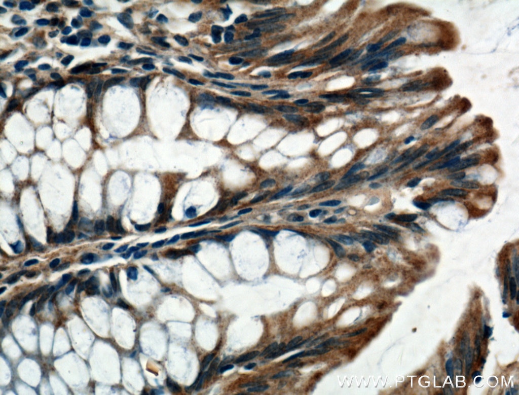 Immunohistochemistry (IHC) staining of human colon tissue using LARS Polyclonal antibody (21146-1-AP)