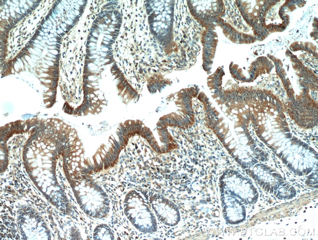Immunohistochemistry (IHC) staining of human colon tissue using LARS Polyclonal antibody (21146-1-AP)