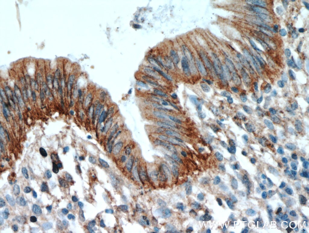 Immunohistochemistry (IHC) staining of human colon tissue using LARS Polyclonal antibody (21146-1-AP)