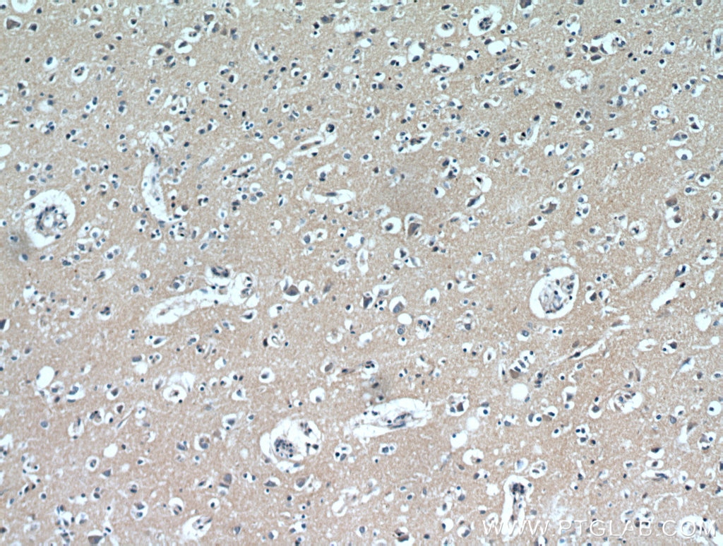 Immunohistochemistry (IHC) staining of human brain tissue using LARS Polyclonal antibody (21146-1-AP)