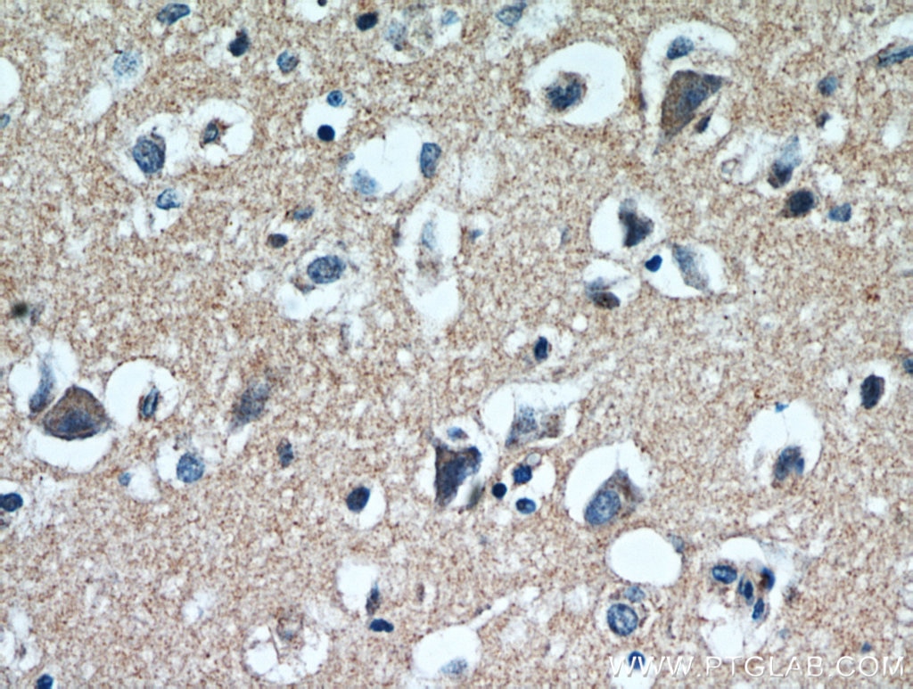 Immunohistochemistry (IHC) staining of human brain tissue using LARS Polyclonal antibody (21146-1-AP)