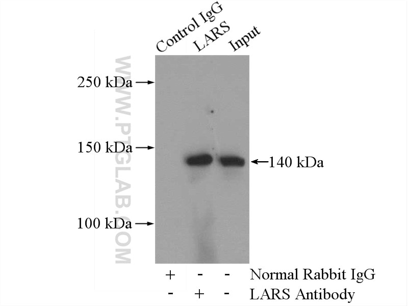 Immunoprecipitation (IP) experiment of Jurkat cells using LARS Polyclonal antibody (21146-1-AP)