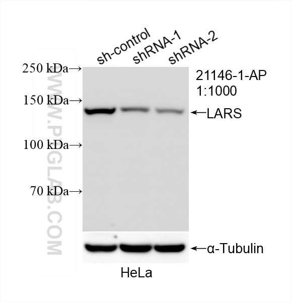 Western Blot (WB) analysis of HeLa cells using LARS Polyclonal antibody (21146-1-AP)