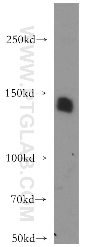 Western Blot (WB) analysis of Y79 cells using LARS Polyclonal antibody (21146-1-AP)