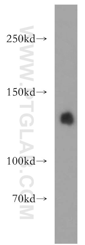 LARS Polyclonal antibody