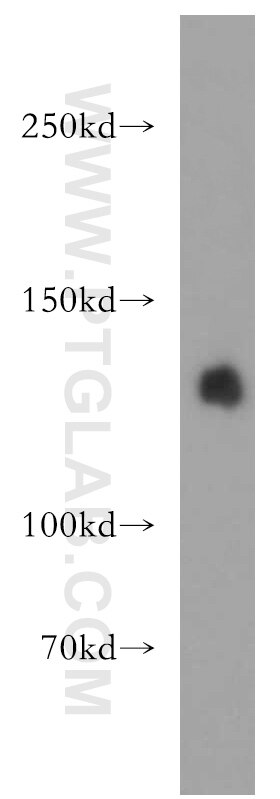 LARS Polyclonal antibody