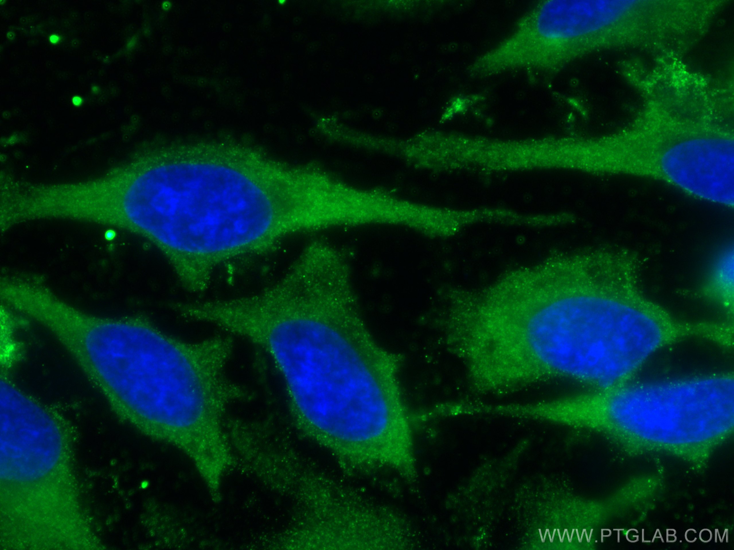 Immunofluorescence (IF) / fluorescent staining of HeLa cells using LARS Monoclonal antibody (67940-1-Ig)