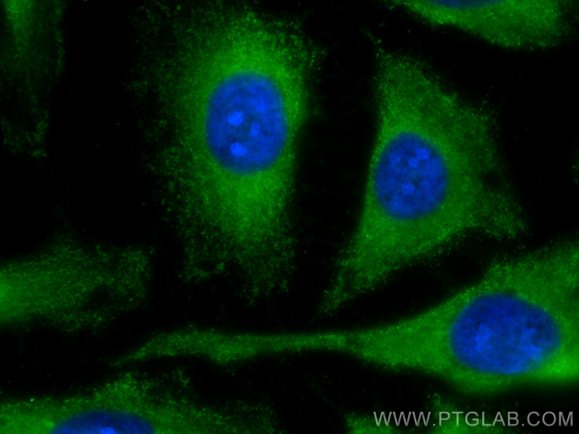 Immunofluorescence (IF) / fluorescent staining of HeLa cells using CoraLite® Plus 488-conjugated LARS Monoclonal anti (CL488-67940)
