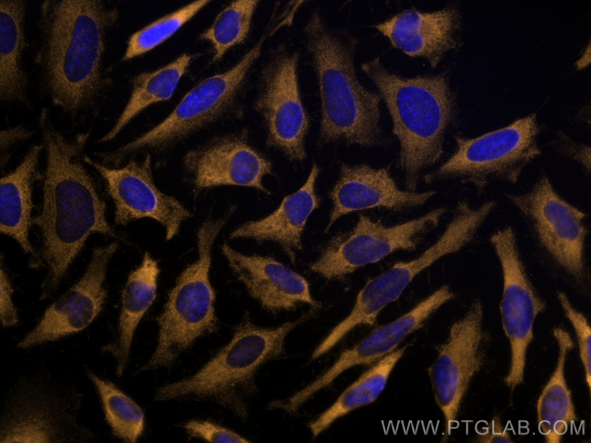 Immunofluorescence (IF) / fluorescent staining of HeLa cells using CoraLite®555-conjugated LARS Monoclonal antibody (CL555-67940)