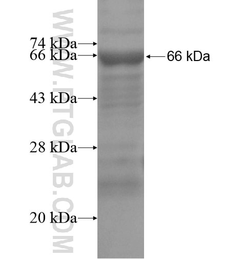 LARS fusion protein Ag15684 SDS-PAGE