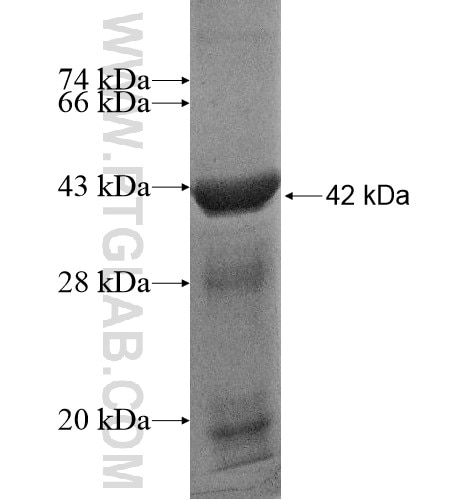 LARS fusion protein Ag15944 SDS-PAGE