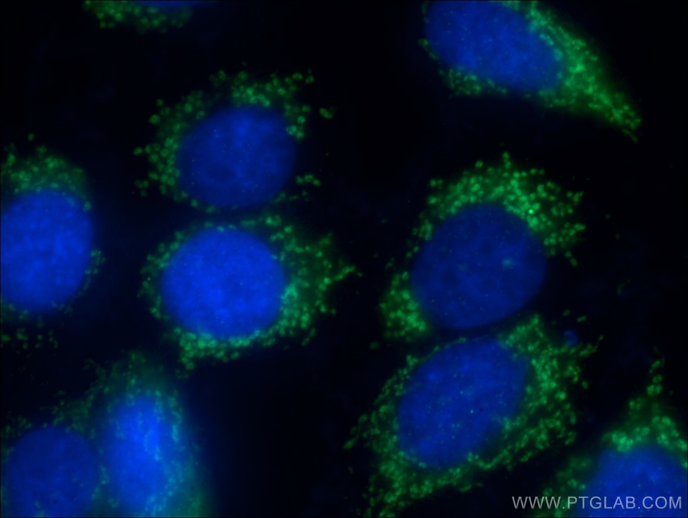 Immunofluorescence (IF) / fluorescent staining of HepG2 cells using LARS2 Polyclonal antibody (17097-1-AP)