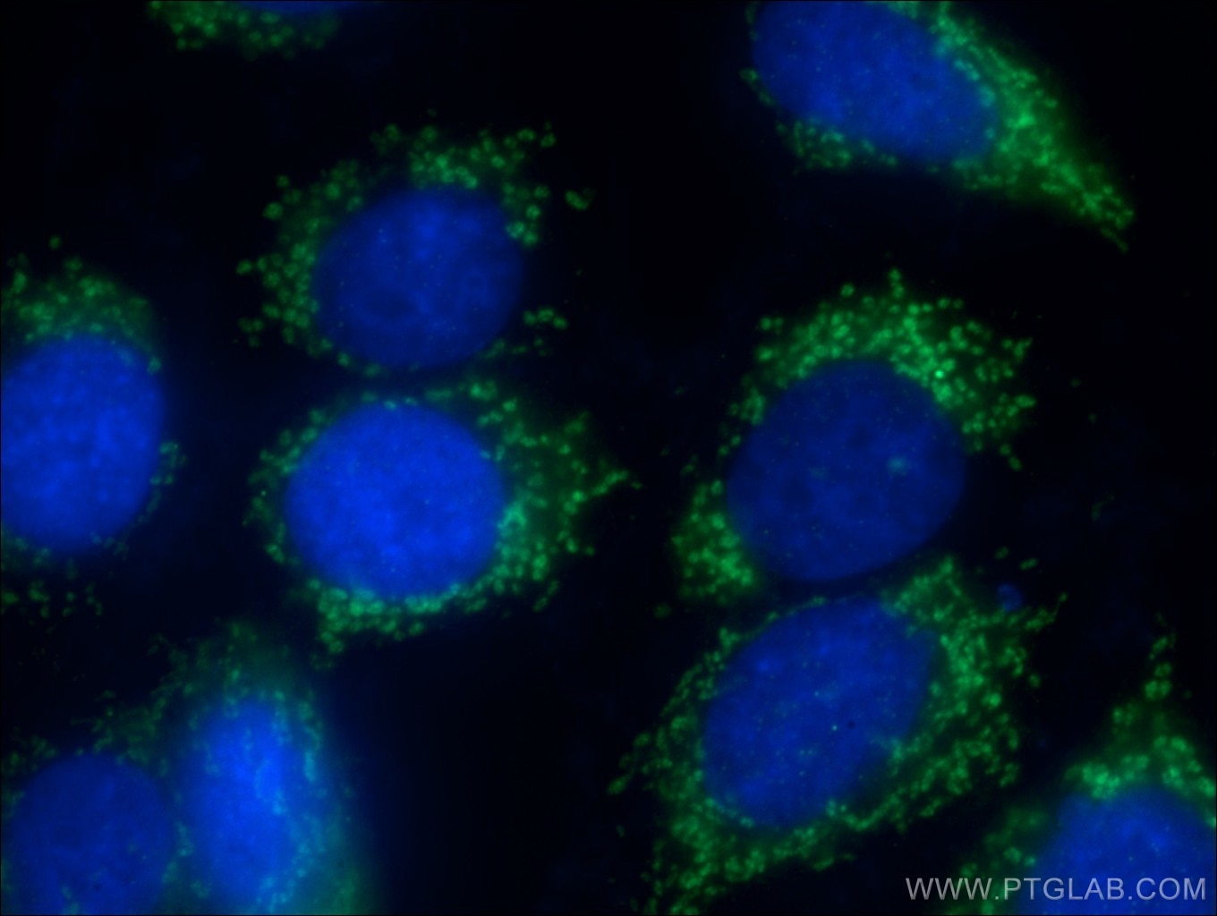 IF Staining of HepG2 using 17097-1-AP