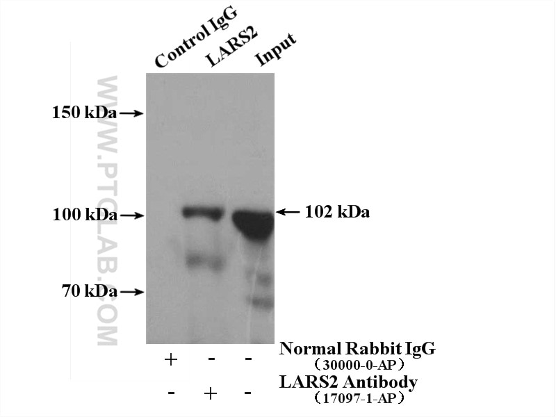 Immunoprecipitation (IP) experiment of Jurkat cells using LARS2 Polyclonal antibody (17097-1-AP)