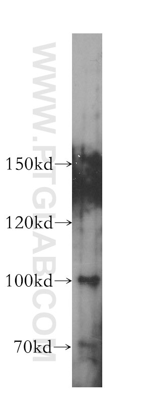 Western Blot (WB) analysis of Jurkat cells using LARS2 Polyclonal antibody (17097-1-AP)