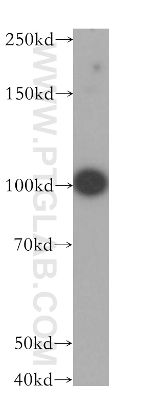 Western Blot (WB) analysis of HepG2 cells using LARS2 Polyclonal antibody (17097-1-AP)