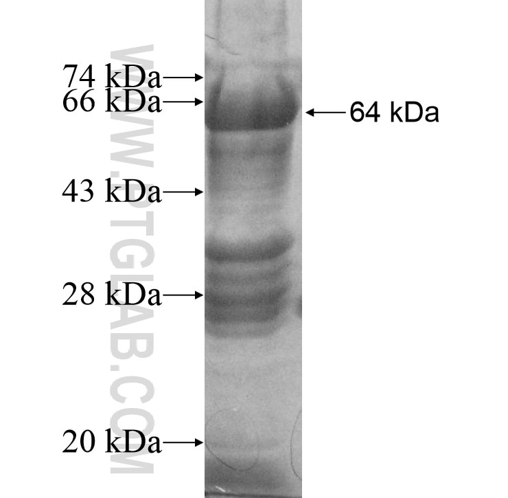 LARS2 fusion protein Ag10576 SDS-PAGE