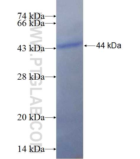 LARS2 fusion protein Ag10838 SDS-PAGE