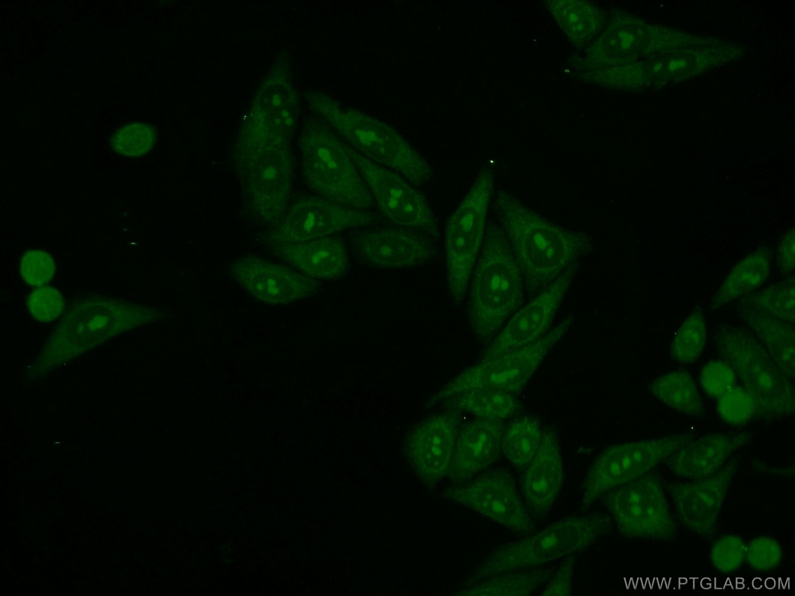 Immunofluorescence (IF) / fluorescent staining of HepG2 cells using LAS1L Polyclonal antibody (16010-1-AP)