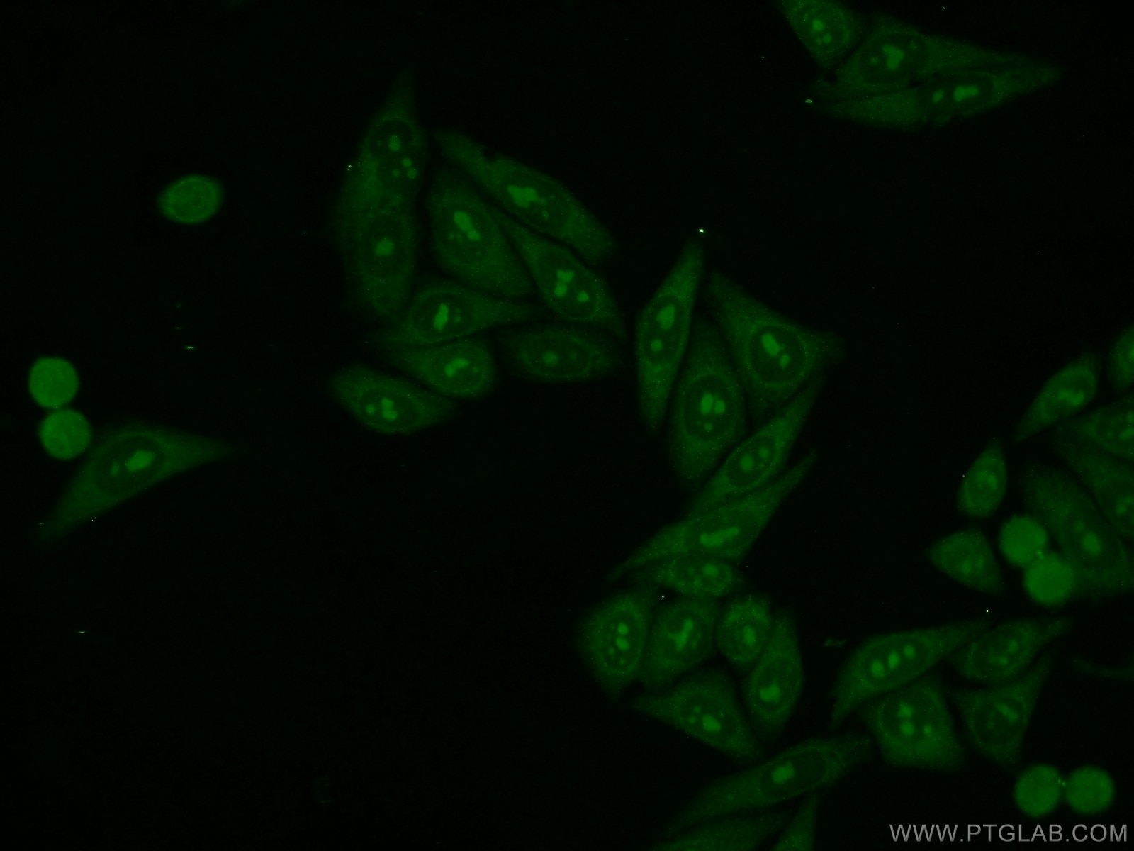 IF Staining of HepG2 using 16010-1-AP