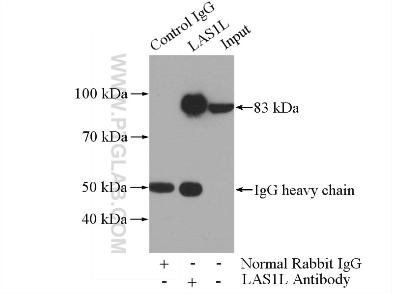 Immunoprecipitation (IP) experiment of HEK-293 cells using LAS1L Polyclonal antibody (16010-1-AP)