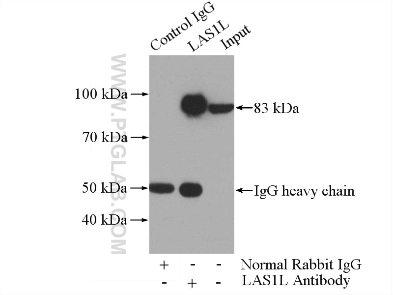 IP experiment of HEK-293 using 16010-1-AP