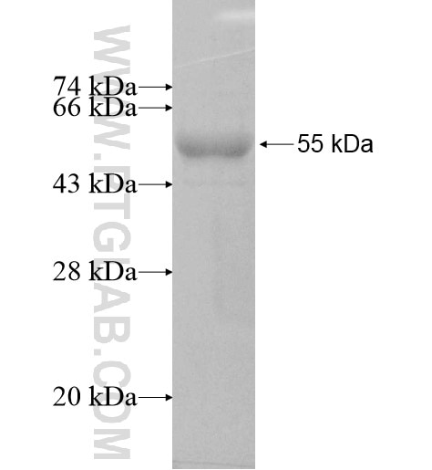 LAS1L fusion protein Ag8881 SDS-PAGE