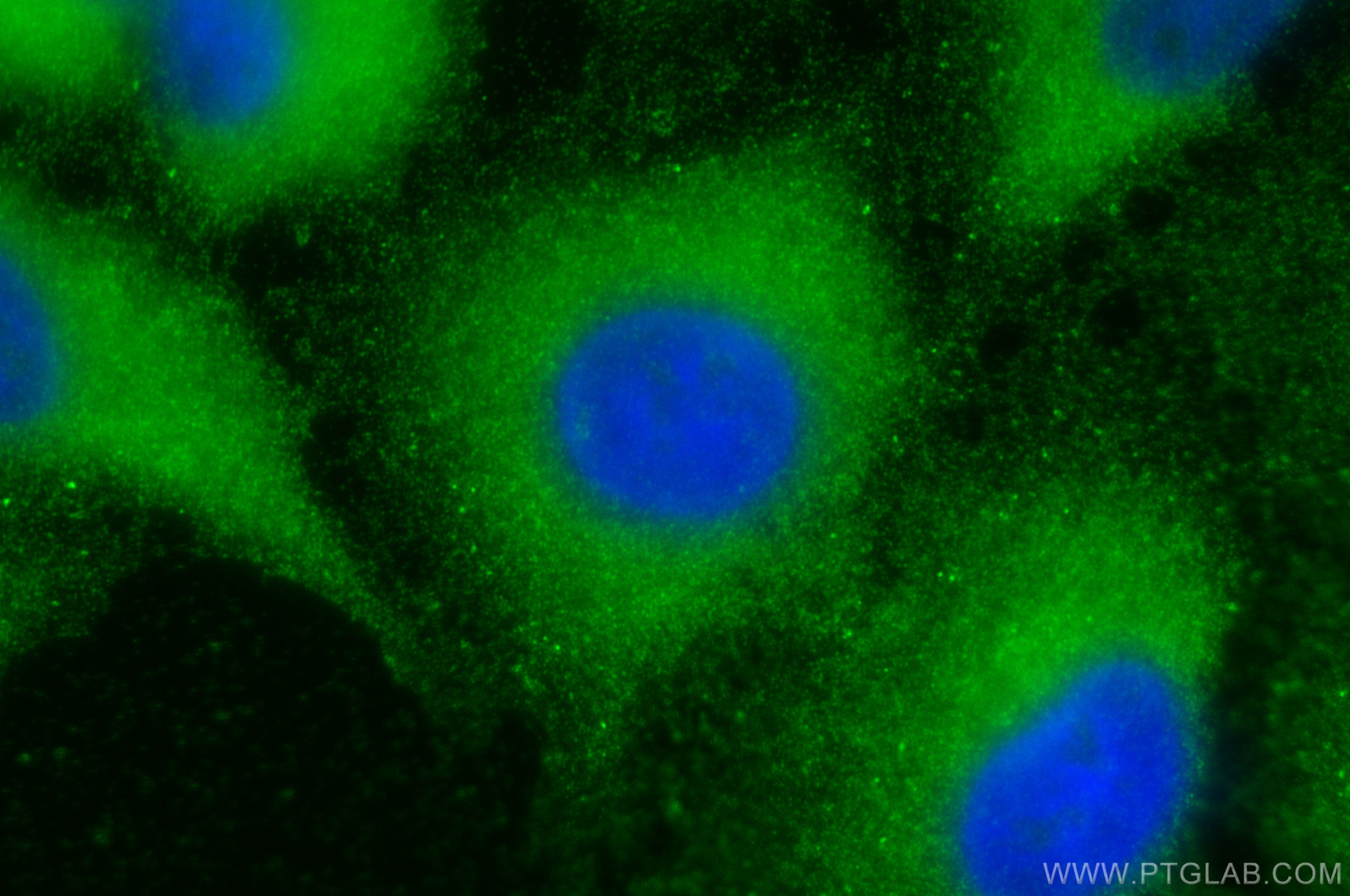 Immunofluorescence (IF) / fluorescent staining of A549 cells using LASP1 Polyclonal antibody (10515-1-AP)
