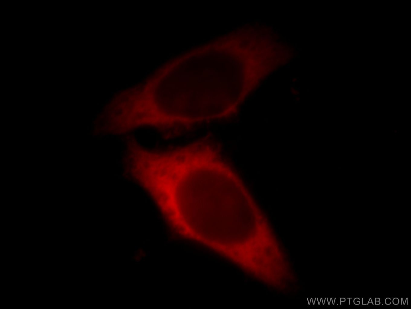 Immunofluorescence (IF) / fluorescent staining of HeLa cells using LASP1 Polyclonal antibody (10515-1-AP)