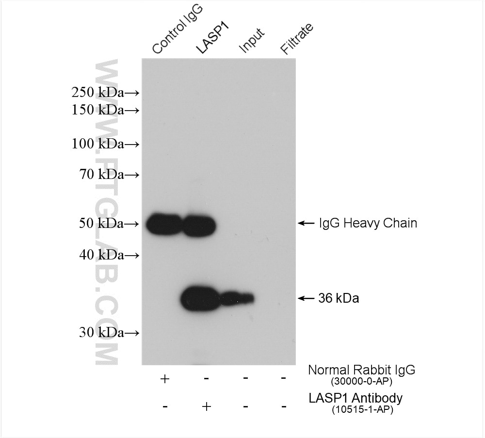 Immunoprecipitation (IP) experiment of A549 cells using LASP1 Polyclonal antibody (10515-1-AP)