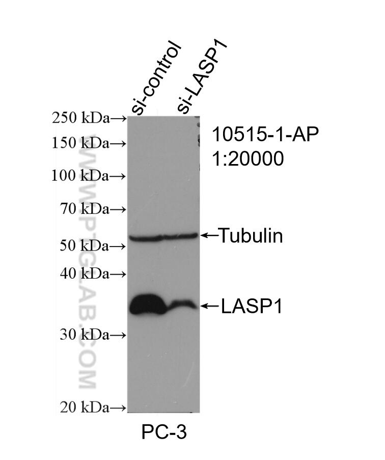 Western Blot (WB) analysis of PC-3 cells using LASP1 Polyclonal antibody (10515-1-AP)