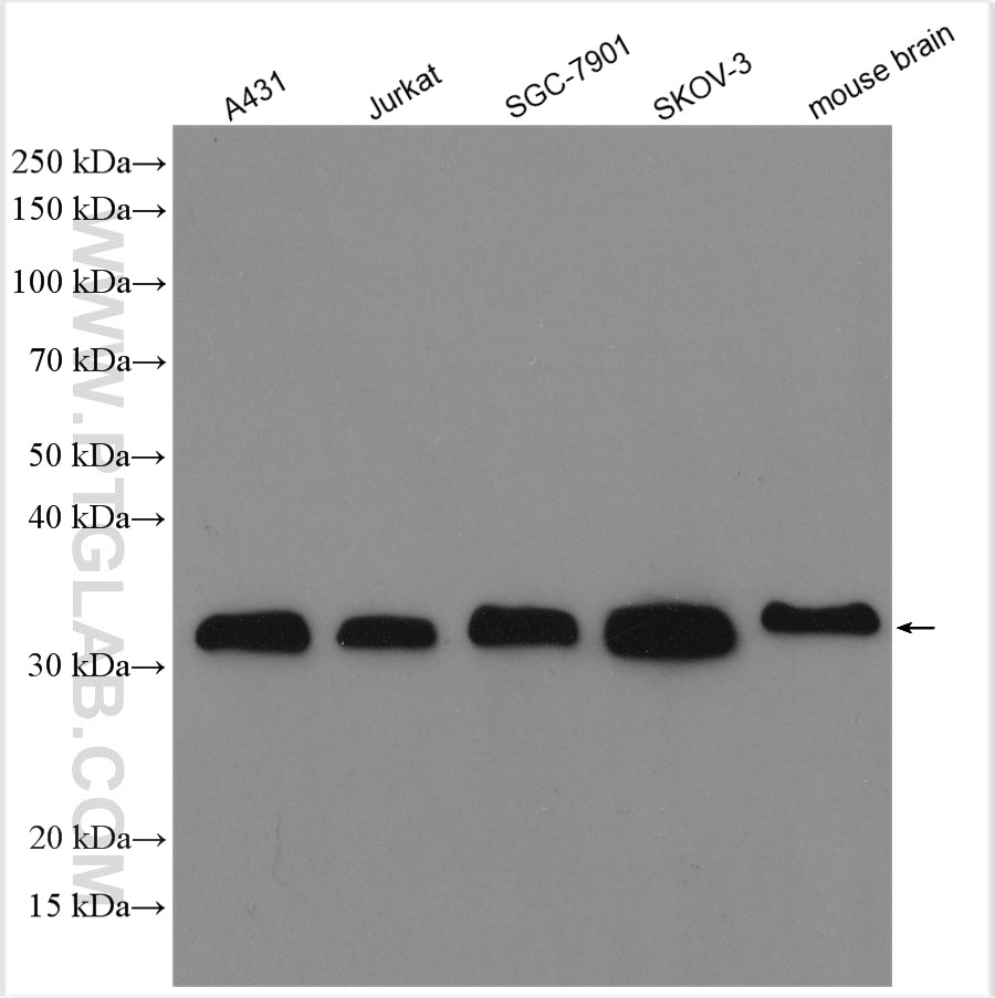 Western Blot (WB) analysis of various lysates using LASP1 Polyclonal antibody (10515-1-AP)