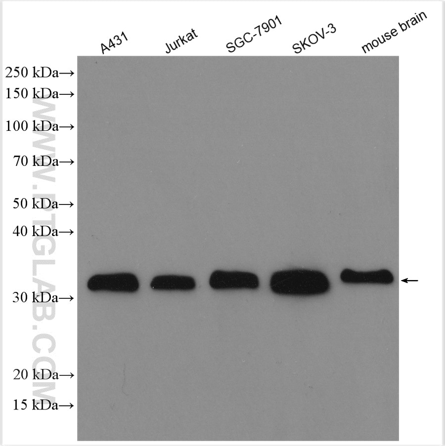 Western Blot (WB) analysis of various lysates using LASP1 Polyclonal antibody (10515-1-AP)
