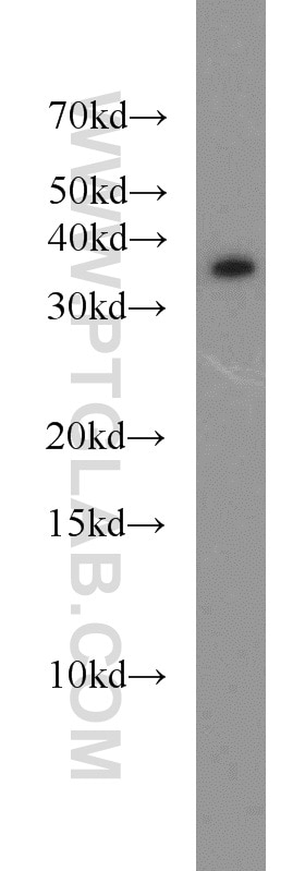 Western Blot (WB) analysis of MDA-MB-453s cells using LASP1 Polyclonal antibody (10515-1-AP)