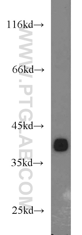 Western Blot (WB) analysis of mouse brain tissue using LASP1 Polyclonal antibody (10515-1-AP)