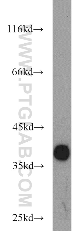 Western Blot (WB) analysis of PC-3 cells using LASP1 Polyclonal antibody (10515-1-AP)