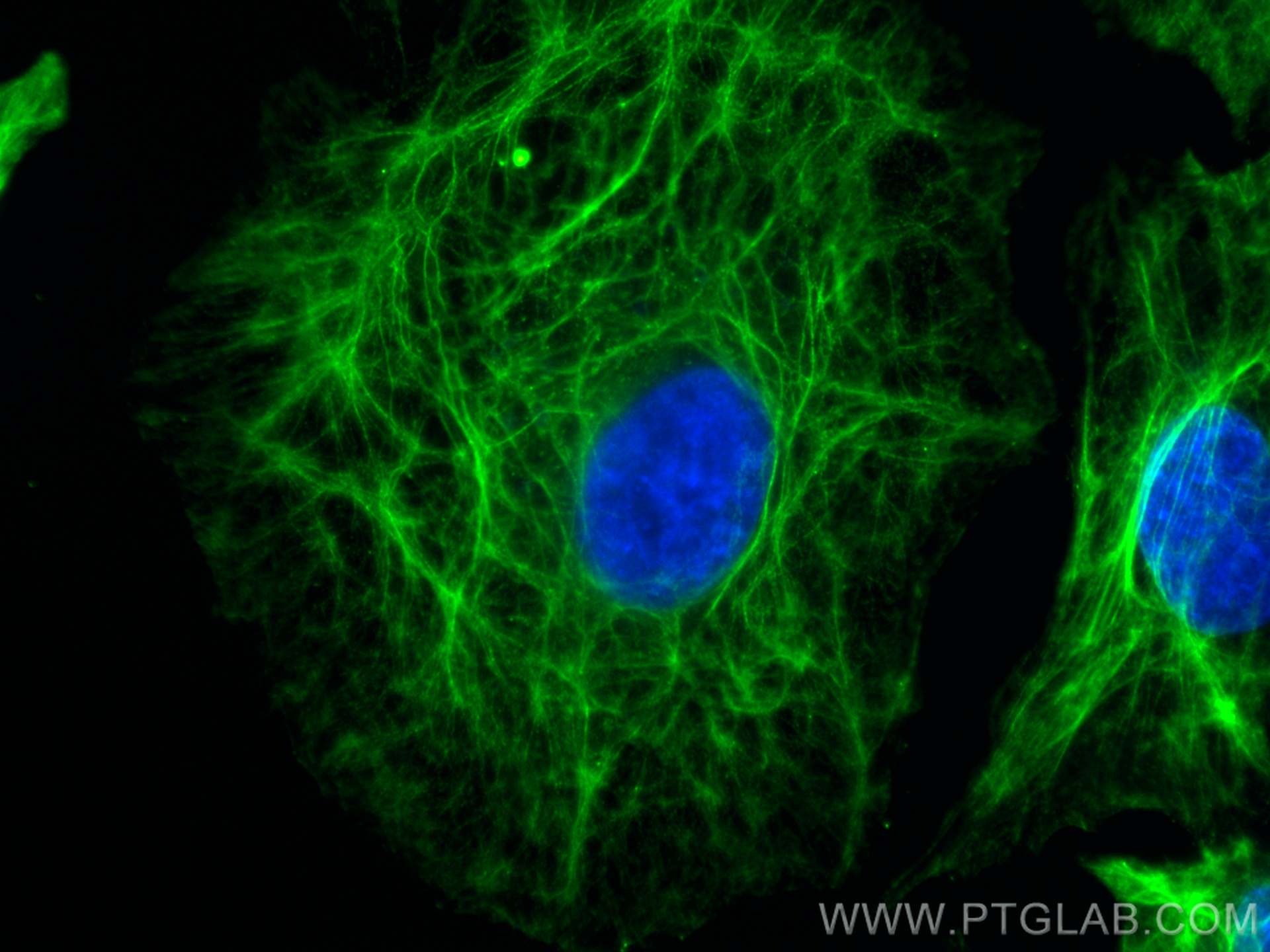 Immunofluorescence (IF) / fluorescent staining of A549 cells using LASP1 Monoclonal antibody (68080-1-Ig)