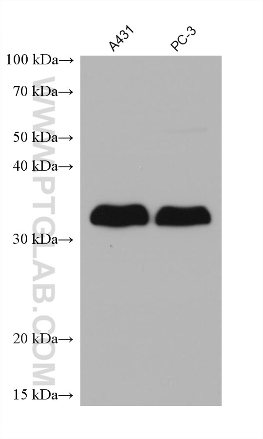 Western Blot (WB) analysis of various lysates using LASP1 Monoclonal antibody (68080-1-Ig)