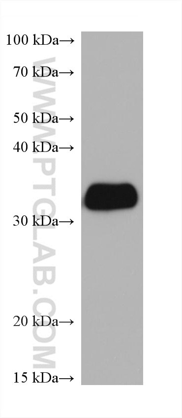 Western Blot (WB) analysis of human peripheral blood platelets using LASP1 Monoclonal antibody (68080-1-Ig)