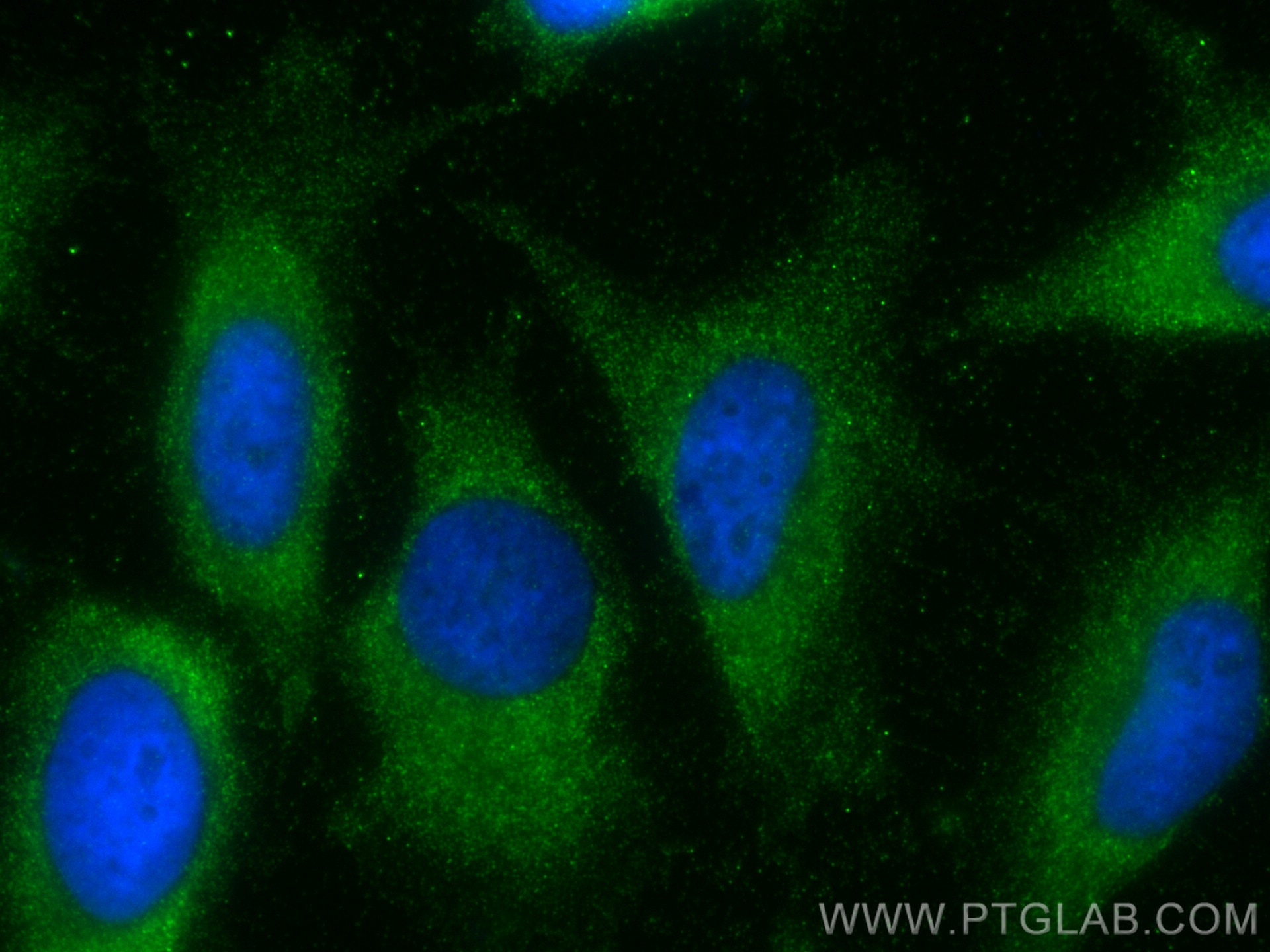 Immunofluorescence (IF) / fluorescent staining of HeLa cells using human LASP1 Recombinant antibody (82491-1-RR)