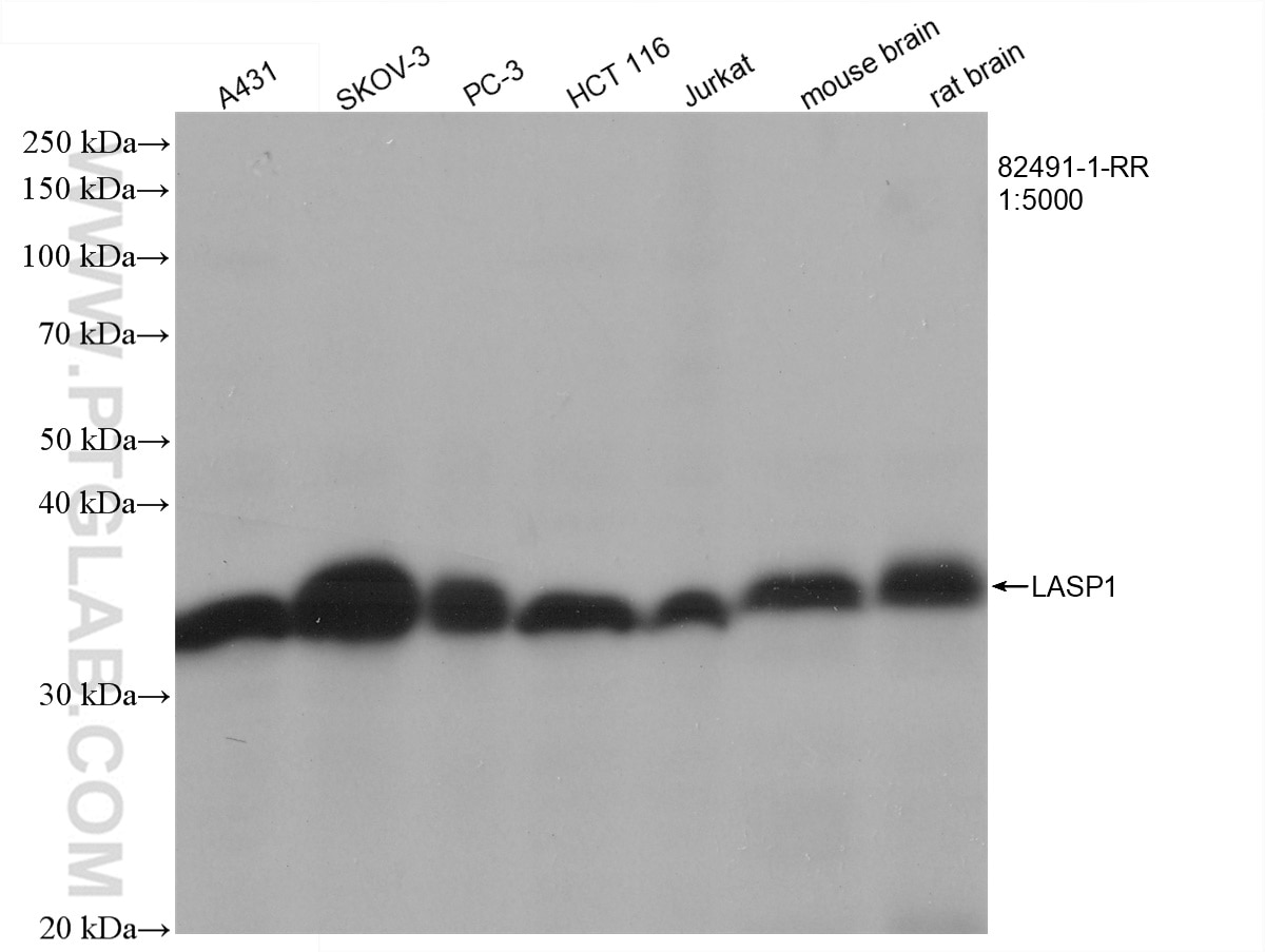 Western Blot (WB) analysis of various lysates using LASP1 Recombinant antibody (82491-1-RR)